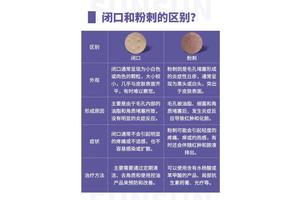 2025年粉刺爆发？熬夜/压力大/护肤错？