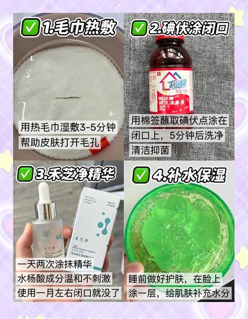 痘痘反复爆发?为何夏季护肤更易长痘?