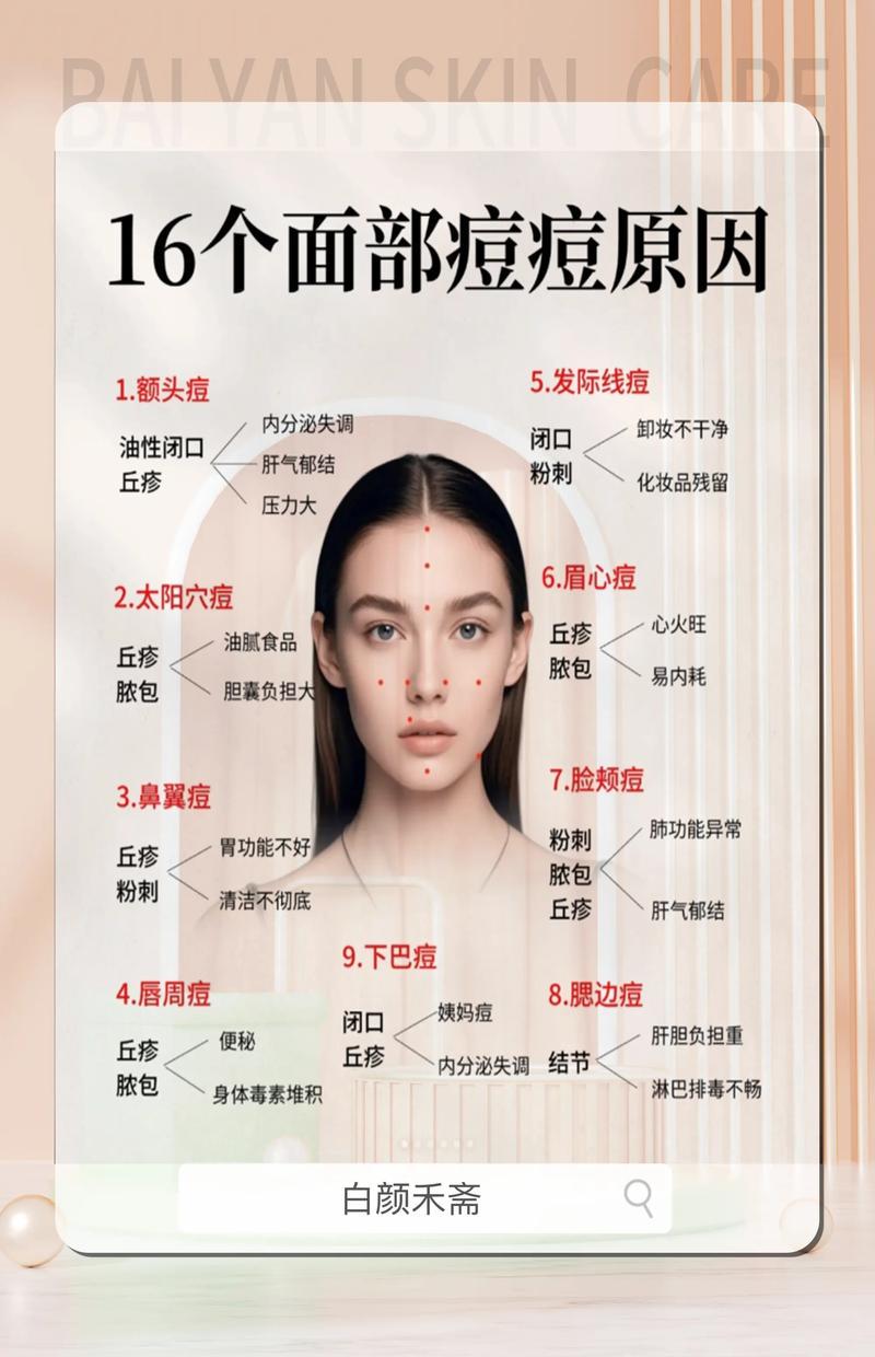 脸颊长痘是内分泌失调还是护肤没做到位?