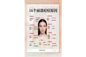 脸颊长痘是内分泌失调还是护肤没做到位？