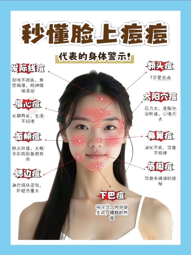 额头痘痘频发?熬夜压力大还是护肤没做到位?