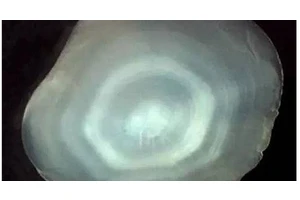 如何判断一条鱼的年龄？