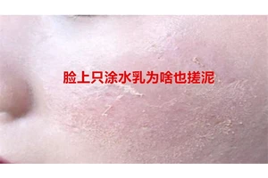 脸上只涂水乳为啥也搓泥