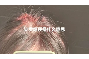 染发爆顶是什么意思
