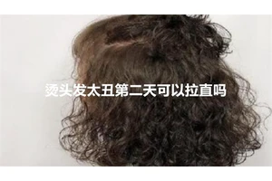 烫头发太丑第二天可以拉直吗