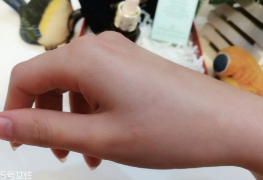 雅诗兰黛适合痘痘肌吗 雅诗兰黛 第5张