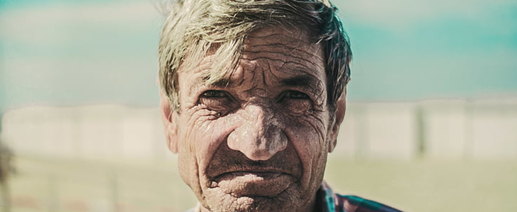 眼角纹和笑纹该怎么去除 眼角纹 笑纹 美妆 第2张