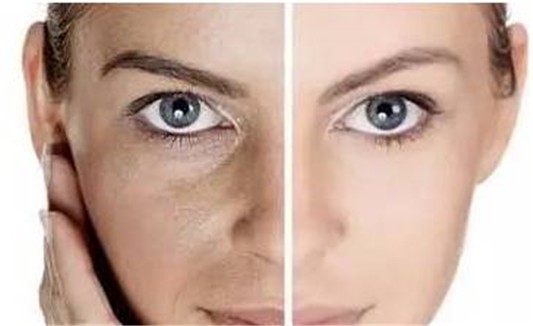 晒黑了多久能恢复 怎么快速变白回 晒黑 快速美白 美妆 第1张