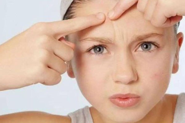 痘痘肌用雅漾还是薇姿 雅漾 薇姿 第1张