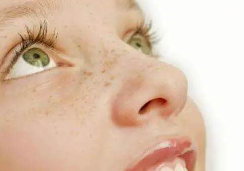 祛斑晒斑黄褐斑怎么办 晒斑 黄褐斑 美妆 第2张