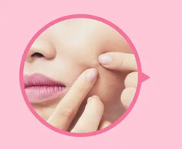 脸上老是出油导致什么皮肤问题 出油 控油方法 美妆 第2张