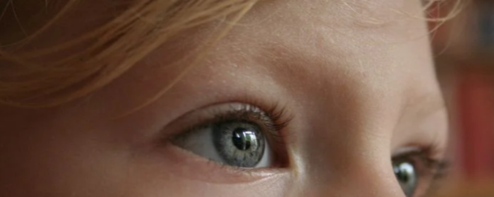 去除鱼尾纹小妙招 去除鱼尾纹 美妆 第3张 去除鱼尾纹小妙招 去除鱼尾纹 美妆 第3张