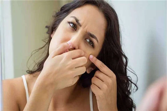 挤完痘痘可以用爽肤水吗 爽肤水 护肤品 第2张