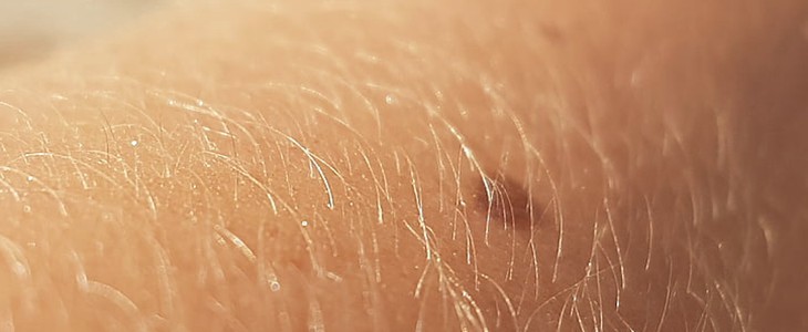 可以永久性脱毛吗 永久脱毛 美妆 第1张