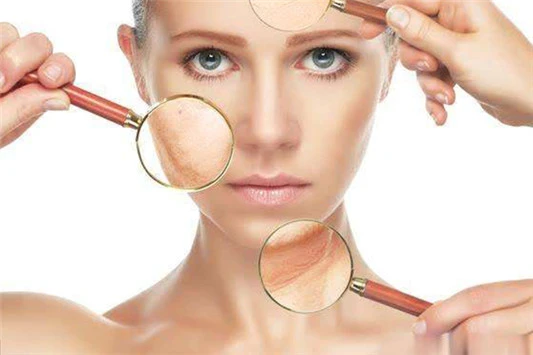 混油皮痘痘肌水乳推荐 爽肤水 乳液 第3张