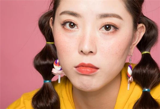 黄褐斑和雀斑的区别 黄褐斑 雀斑 第2张