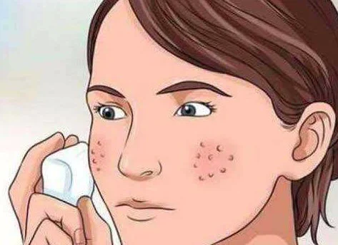 青春期最简单的收缩毛孔方法 收缩毛孔 收缩毛孔方法 美妆 第2张