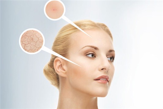 混油混干分辨小妙招 爽肤水 第1张 混油混干分辨小妙招 爽肤水 第1张