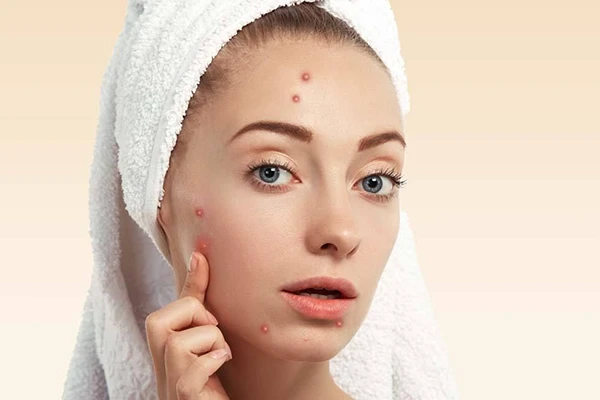 茵芙莎流金水功效 茵芙莎 爽肤水 第3张