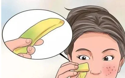 香蕉皮可以擦脸上可以祛斑吗 香蕉皮 香蕉皮祛斑 美妆 第2张