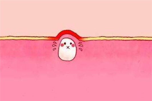 起闭口的原因有哪些 闭口 第1张