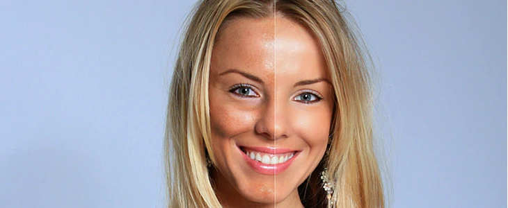 肤色暗沉是什么原因 肤色暗沉 美妆 第2张