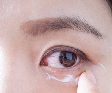 眼周细纹怎么消除 细纹 消除细纹 美妆 第1张