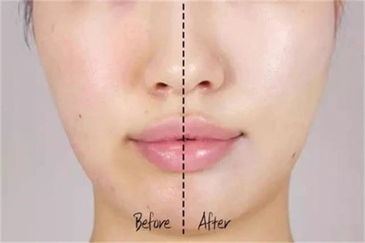 毛孔粗大遮瑕的使用顺序是什么 遮瑕 美妆 第2张