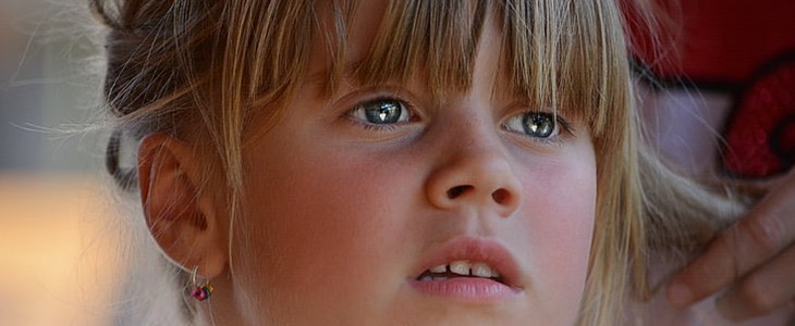 怎么去脸上的红血丝 红血丝 美妆 第2张