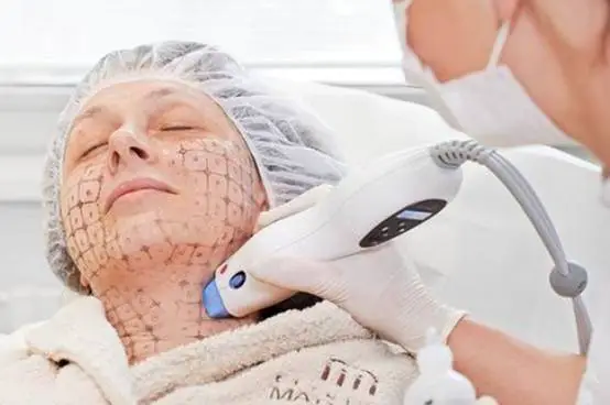 热玛吉4代和5代的区别都有哪些 热玛吉 热玛吉4代 美妆 第2张