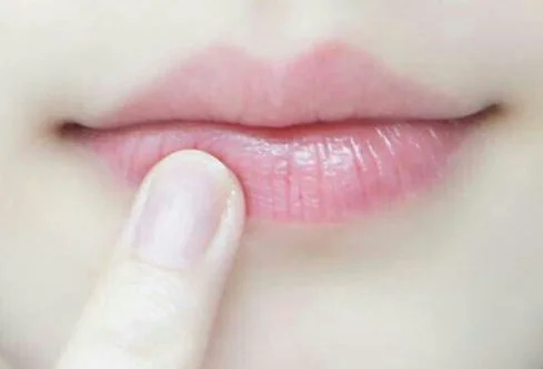 嘴角皮肤发黑是什么造成的 嘴角 嘴角发黑 美妆 第2张