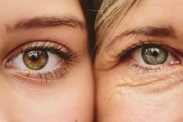 资生堂悠莱眼霜和伊思红参哪个好用 资生堂 伊思 眼霜 第1张