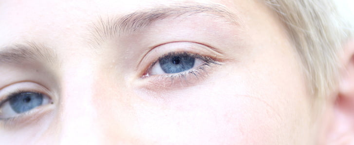 眼皮松弛怎么办 眼皮 松弛 美妆 第3张