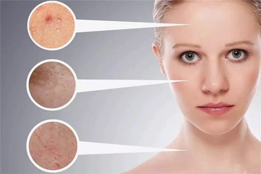 泰国小海藻面膜的功效 海藻面膜 第2张