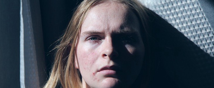 如何减少青春痘 青春痘 美妆 第1张