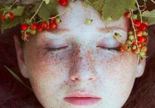 雀斑和黄褐斑的区别 雀斑 黄褐斑 第4张