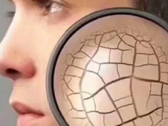 皮肤缺水会有什么样的后果 缺水 皮肤缺水 美妆 第3张