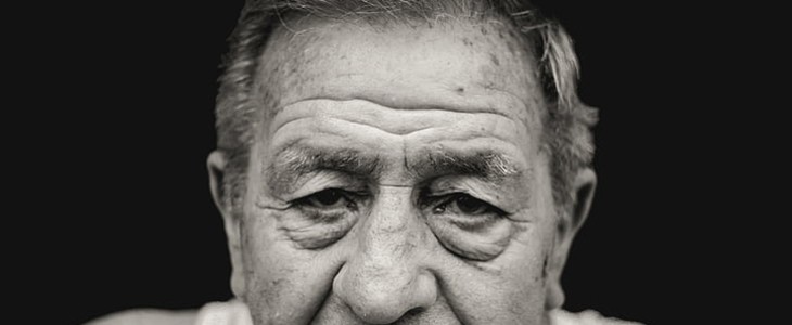 怎样去除脸上老年斑 老年斑 美妆 第1张