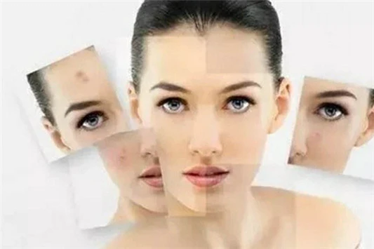 混油皮痘肌隔离推荐 隔离霜 贝玲妃 第4张