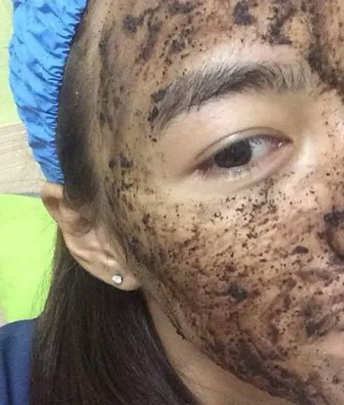 咖啡渣可以去黑眼圈吗 黑眼圈 咖啡渣去黑眼圈 美妆 第3张