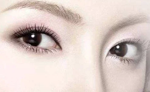 单眼皮可能变双眼皮吗 单眼皮 双眼皮 美妆 第2张