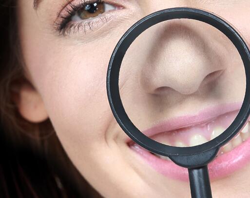 鼻子上的黑头直接挤掉可以吗 黑头 去鼻子黑头 美妆 第1张