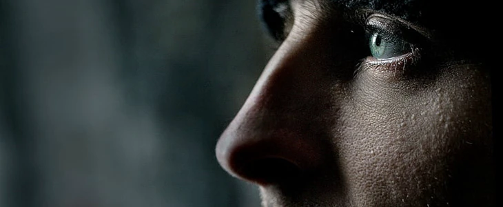 如何消除脂肪粒小妙招 脂肪粒 美妆 第3张