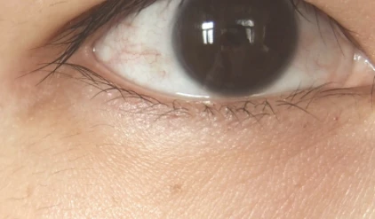 雅诗兰黛适合敏感肌吗 雅诗兰黛 第4张