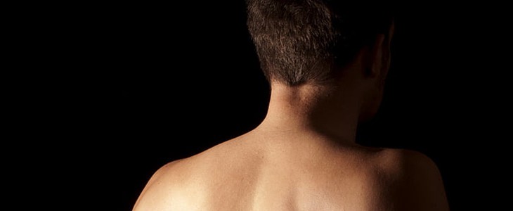 背上长痤疮怎么办 背 痤疮 美妆 第1张