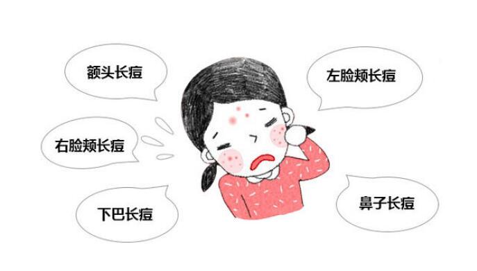 熬夜长痘痘后祛痘方法 熬夜 熬夜祛痘 美妆 第1张