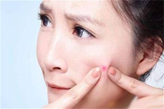 挤痘后多久可以敷面膜 面膜 护肤品 第3张