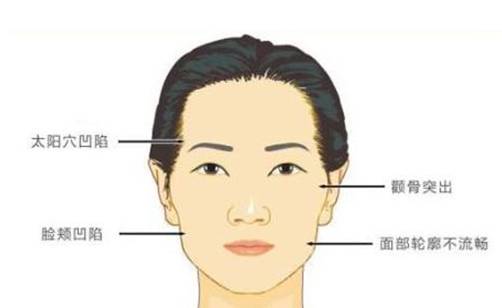 怎么瘦颧骨小窍门 瘦颧骨 瘦颧骨窍门 美妆 第1张