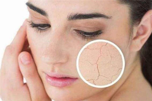 油性皮肤的九大好处 油性皮肤 第3张