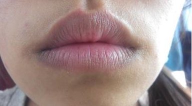 嘴角皮肤发黑是什么造成的 嘴角 嘴角发黑 美妆 第1张